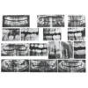 Dental X-Rays Set of 15 with Chart