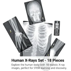 Human X-Rays - Set of 18